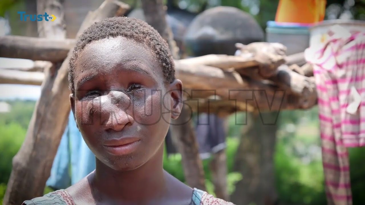 Garbabi: Home of River Blindness