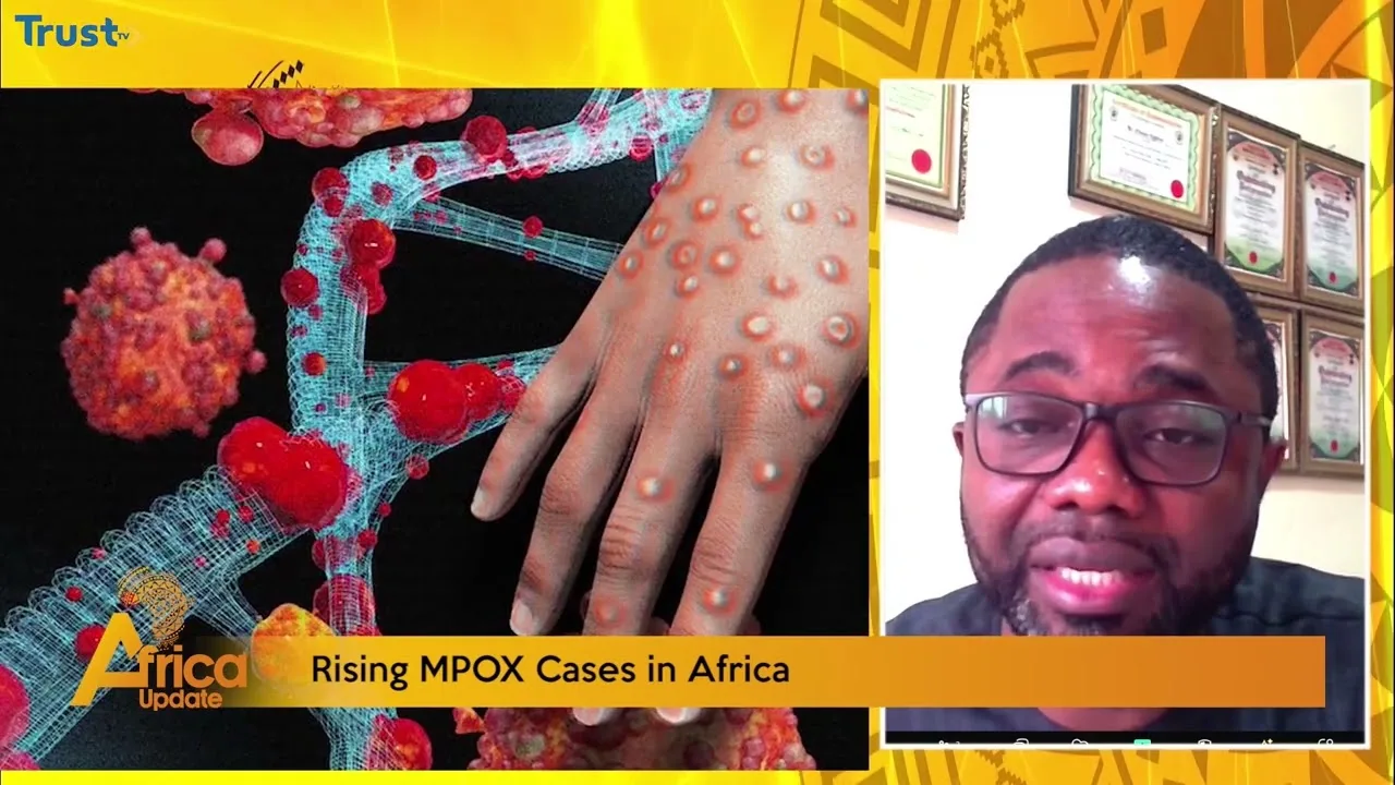 Rising Mpox cases in Africa + more stories across Africa