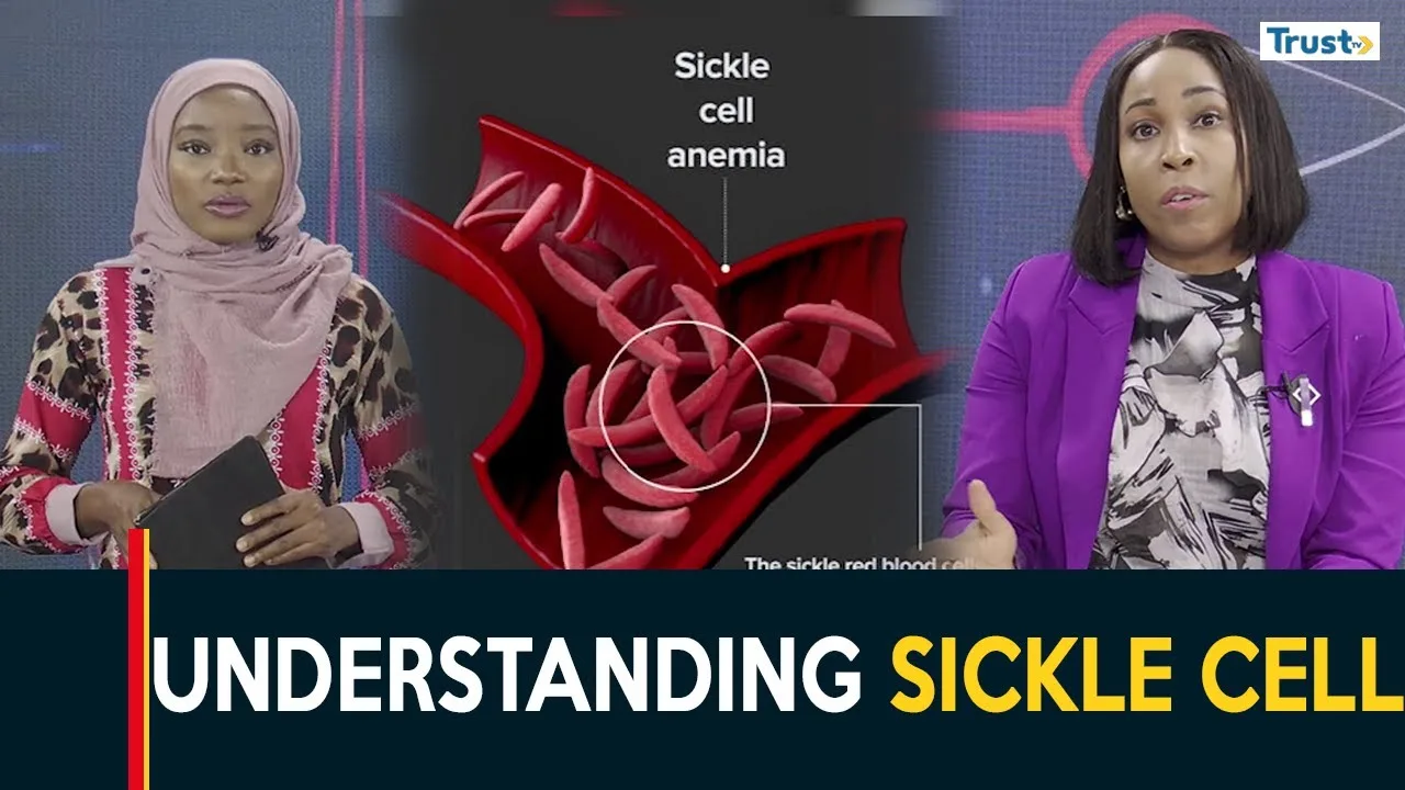 Sickle Cell Awareness Month: Understanding sickle cell