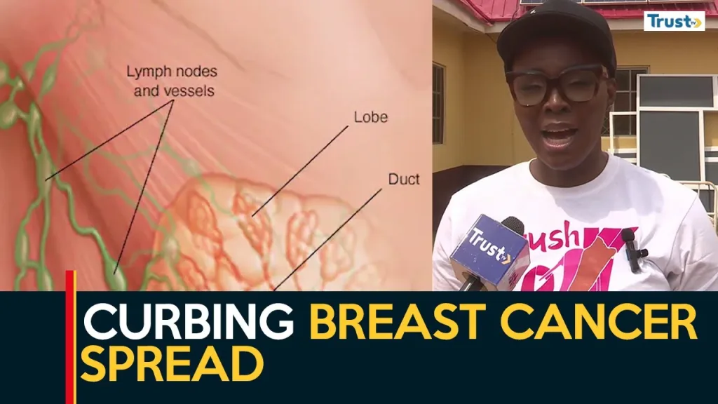 Curbing Breast Cancer Spread: Kaduna women blame myths, cultural practices for rise in menace