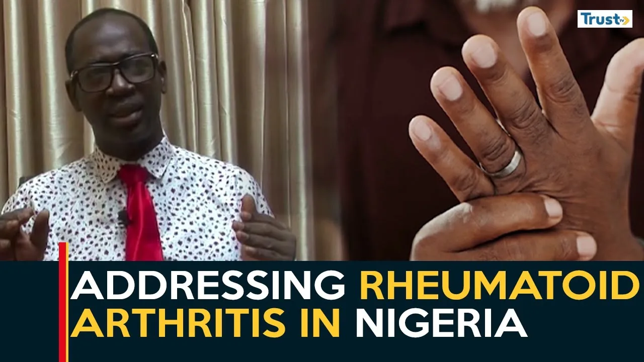 Addressing rheumatoid arthritis in Nigeria
