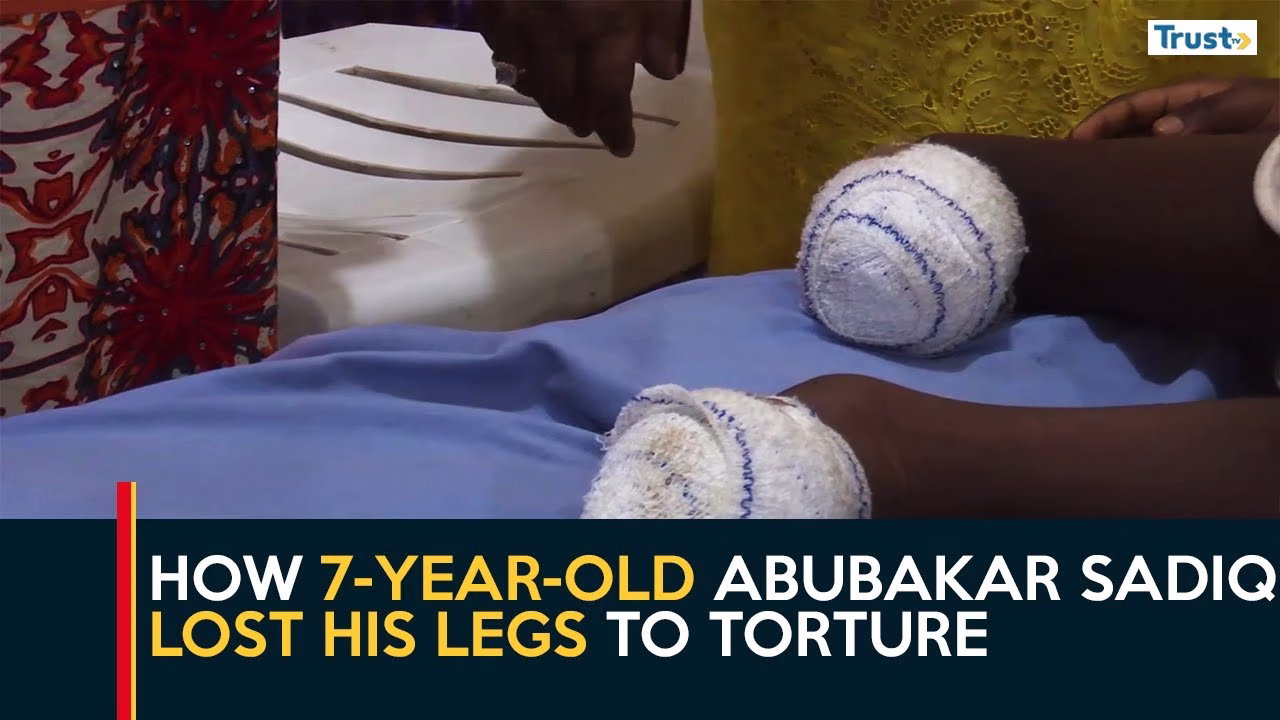 A Father’s Cruelty: How 7-year-old Abubakar Sadiq lost his legs to torture