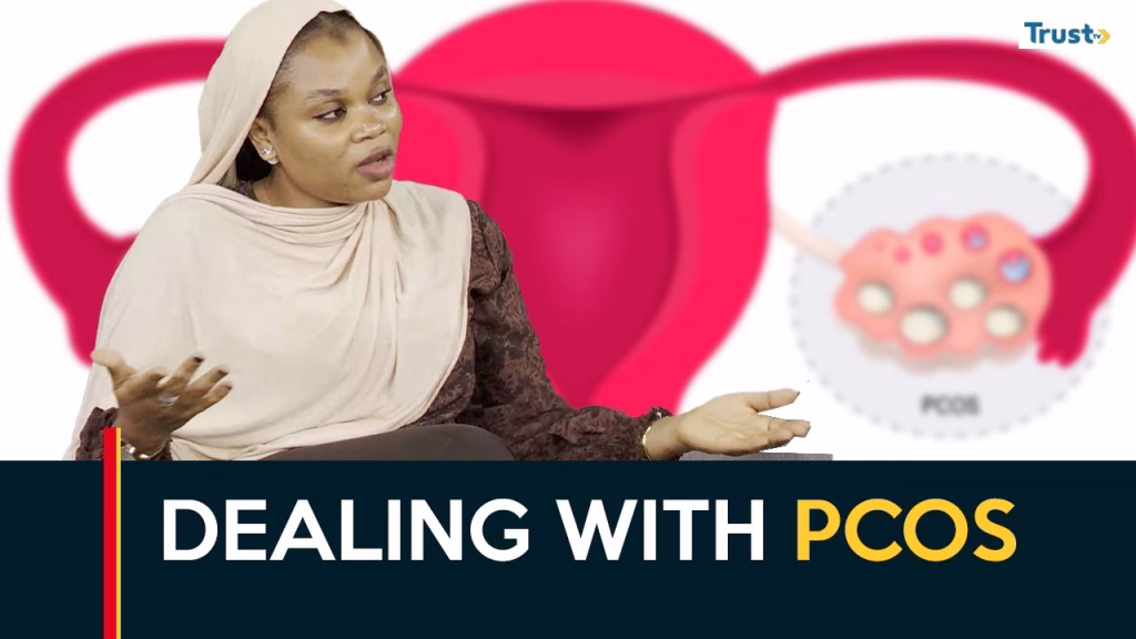 Dealing with PCOS 
