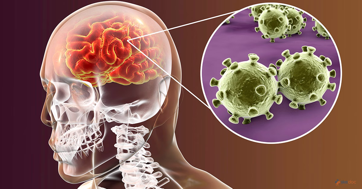 Meningitis kills 33 children in Sokoto